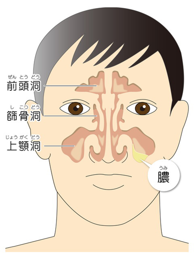 よくある「はな」の病気について